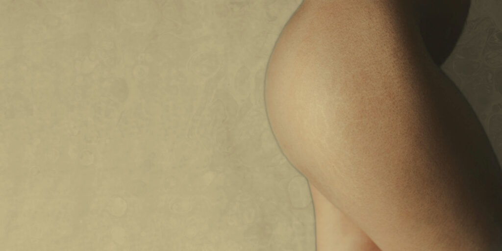 Dra. Evadné Guerrero - Carboxiterapia