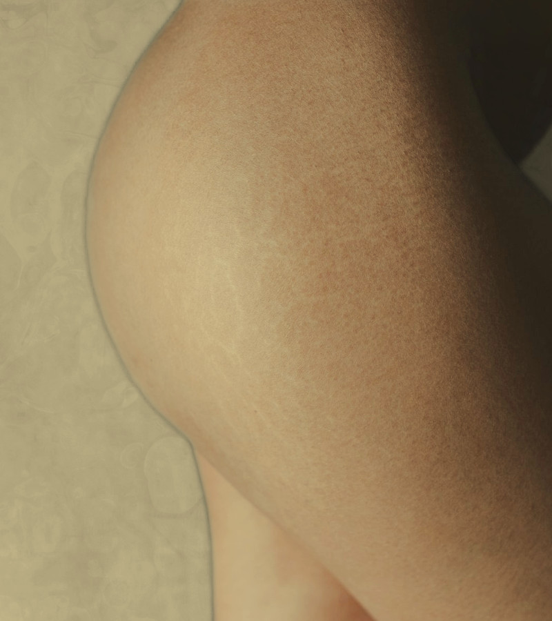 Dra. Evadné Guerrero - Carboxiterapia