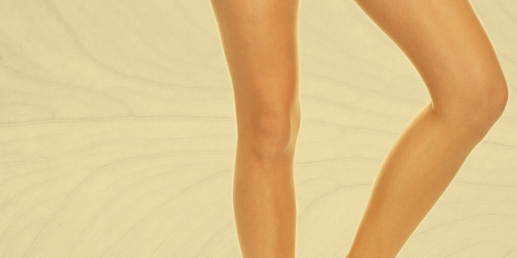 Dra. Evadné Guerrero - Escleroterapia