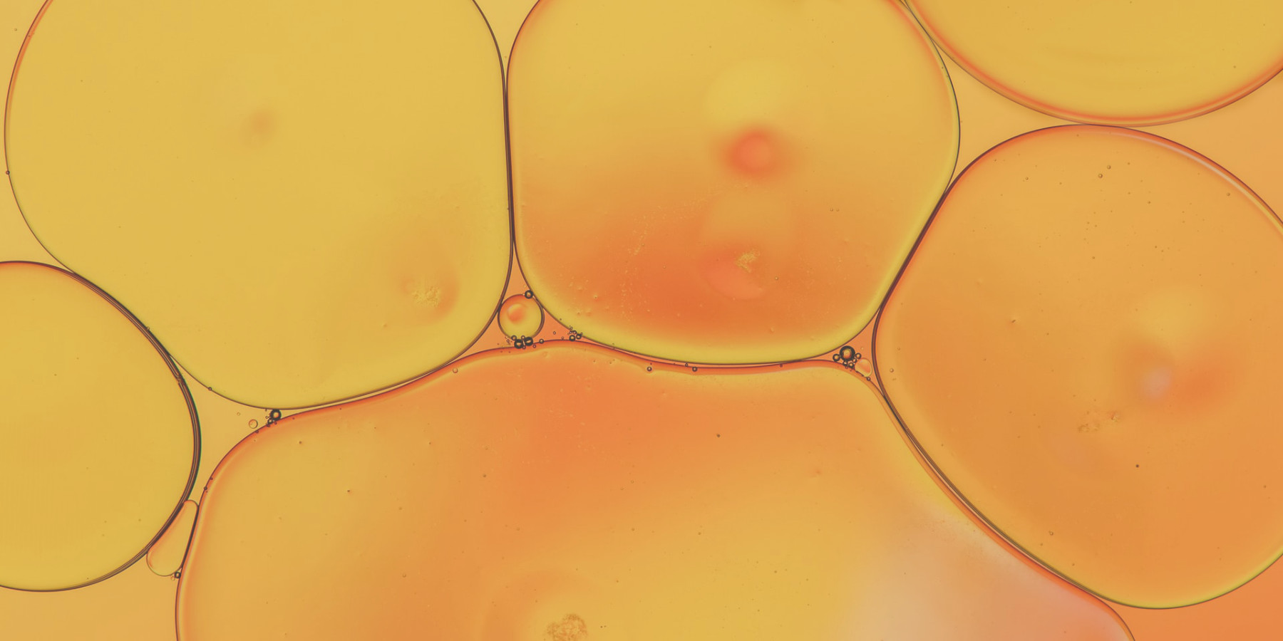 Dra. Evadné Guerrero - Fillers Autólogos